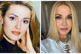 Сумская впервые призналась, почему удалила свою фирменную родинку на лице