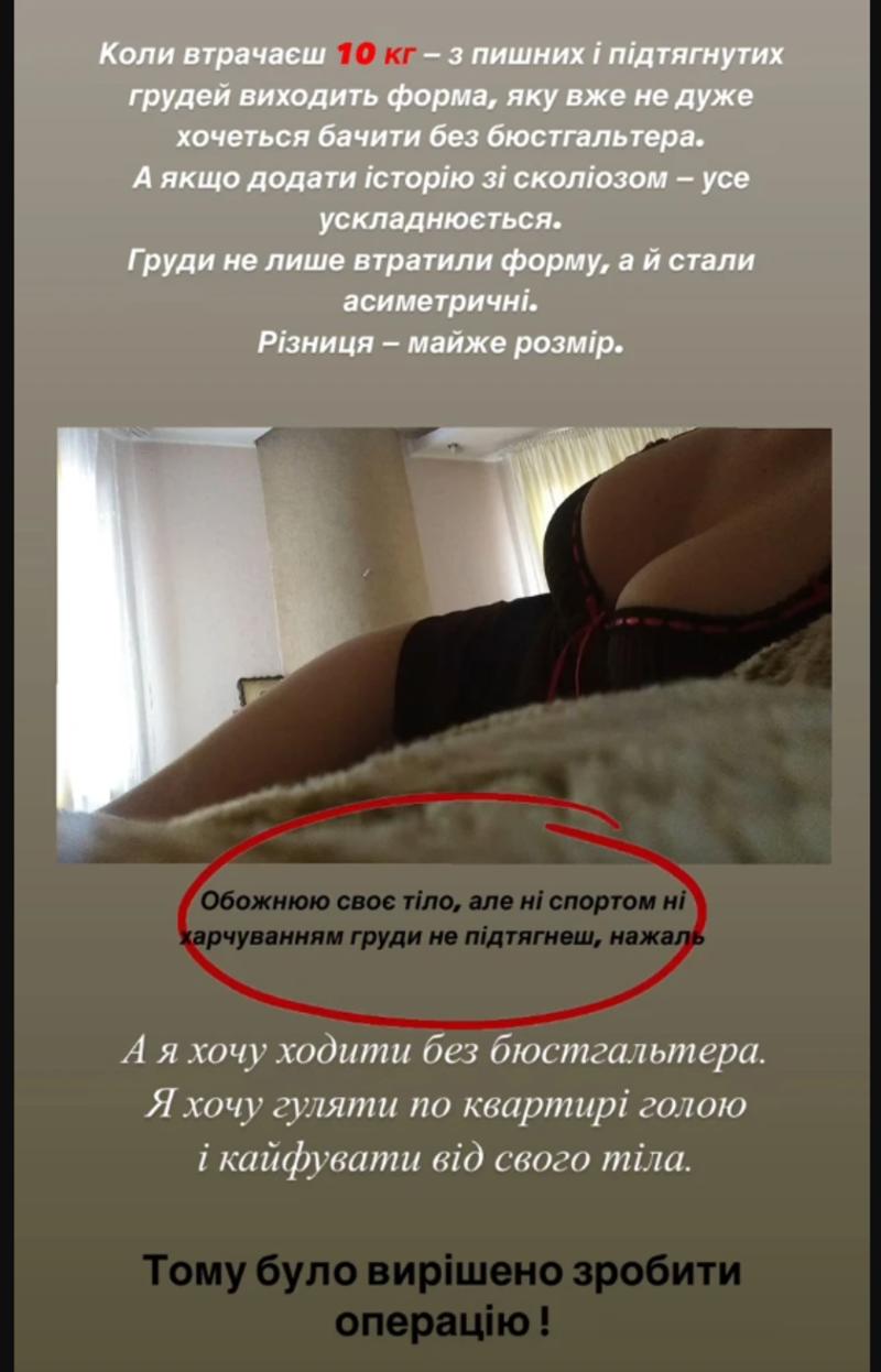 Инна Белень объяснила, почему решилась на маммопластику instagram.com/innka_belen Инна Белень объяснила, почему решилась на маммопластику instagram.com/innka_belen