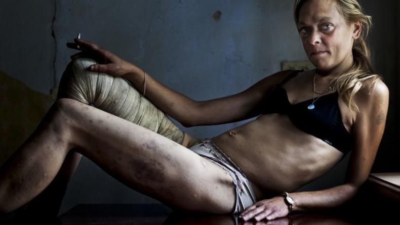 World Press Photo Award: Наркотики и проституция в Украине