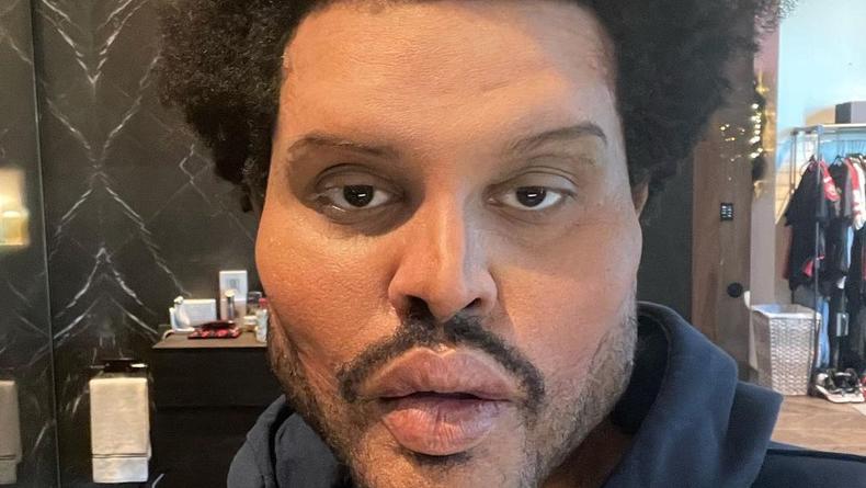 The Weeknd высмеял в новом клипе чрезмерное увлечение пластикой лица