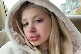 Водителем, который вез блогершу и сбил человека, занялась полиция