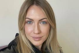 Леся Никитюк поведала, где достала ботокс для губ