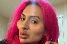Киевлянка с громадными скулами показалась после очередной операции