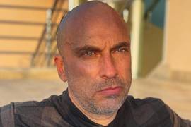 Нагиев рассказал о болезни, из-за которой мучается уже 20 лет