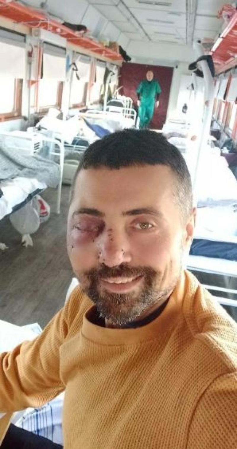 Лінартович був тяжко поранений у боях за місто Соледар. Лінартович був тяжко поранений у боях за місто Соледар.