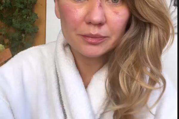 Как Анна Саливанчук выглядит после операции Фото: instagram.com/salivanchuk.anna