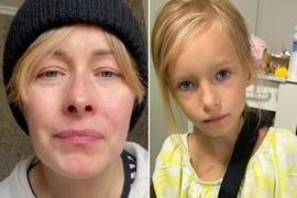 "День был сплошным волнением": Елена Кравец показала сломанную руку своей дочери