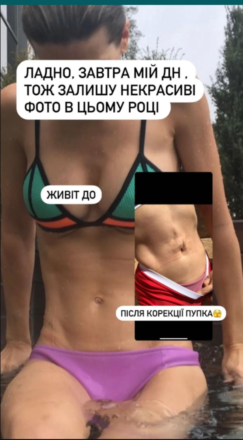Анита Луценко показала живот до и после неудачной операции instagram.com/anitasporty Анита Луценко показала живот до и после неудачной операции instagram.com/anitasporty