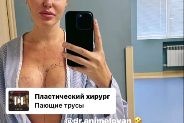 Слава Каминская сделала пластику instagram.com/babaslavka
