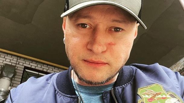 Співак різко висловився стосовно того, що сталося Співак різко висловився стосовно того, що сталося