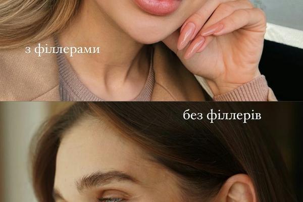 Саша Бо з філерами та без них instagram.com/sashaabo