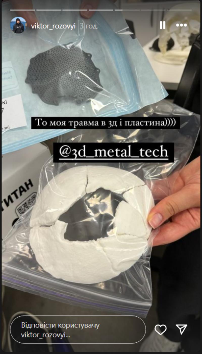 Виктору Розовому вставили титановую пластину в череп instagram.com/viktor_rozovyi Виктору Розовому вставили титановую пластину в череп instagram.com/viktor_rozovyi