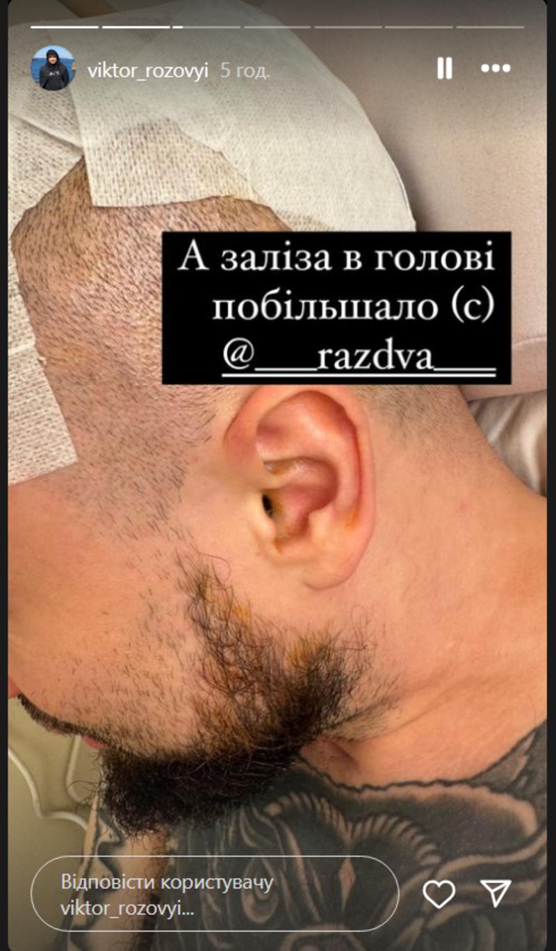 Виктору Розовому вставили титановую пластину в череп instagram.com/viktor_rozovyi Виктору Розовому вставили титановую пластину в череп instagram.com/viktor_rozovyi