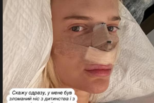Готочкіна зробила пластику instagram.com/got.sveta