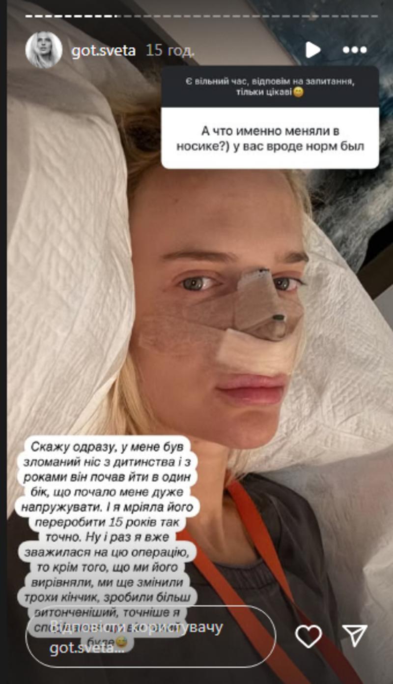 Готочкіна зробила пластику instagram.com/got.sveta Готочкіна зробила пластику instagram.com/got.sveta